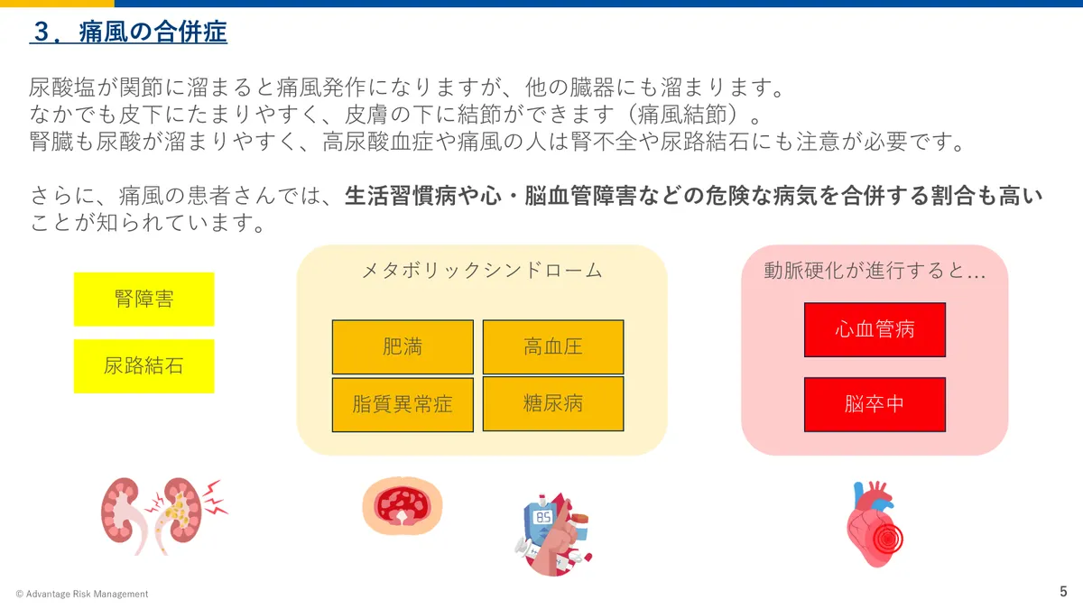 痛風の合併症